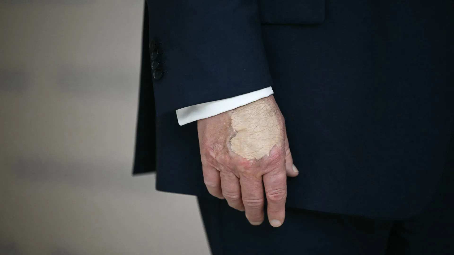 trump-volta-a-usar-maquiagem-na-mao-apos-diagnostico