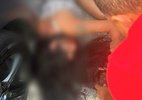 tv:-mulher-diz-que-foi-agredida-por-gato-preto-apos-encostar-em-seu-carro