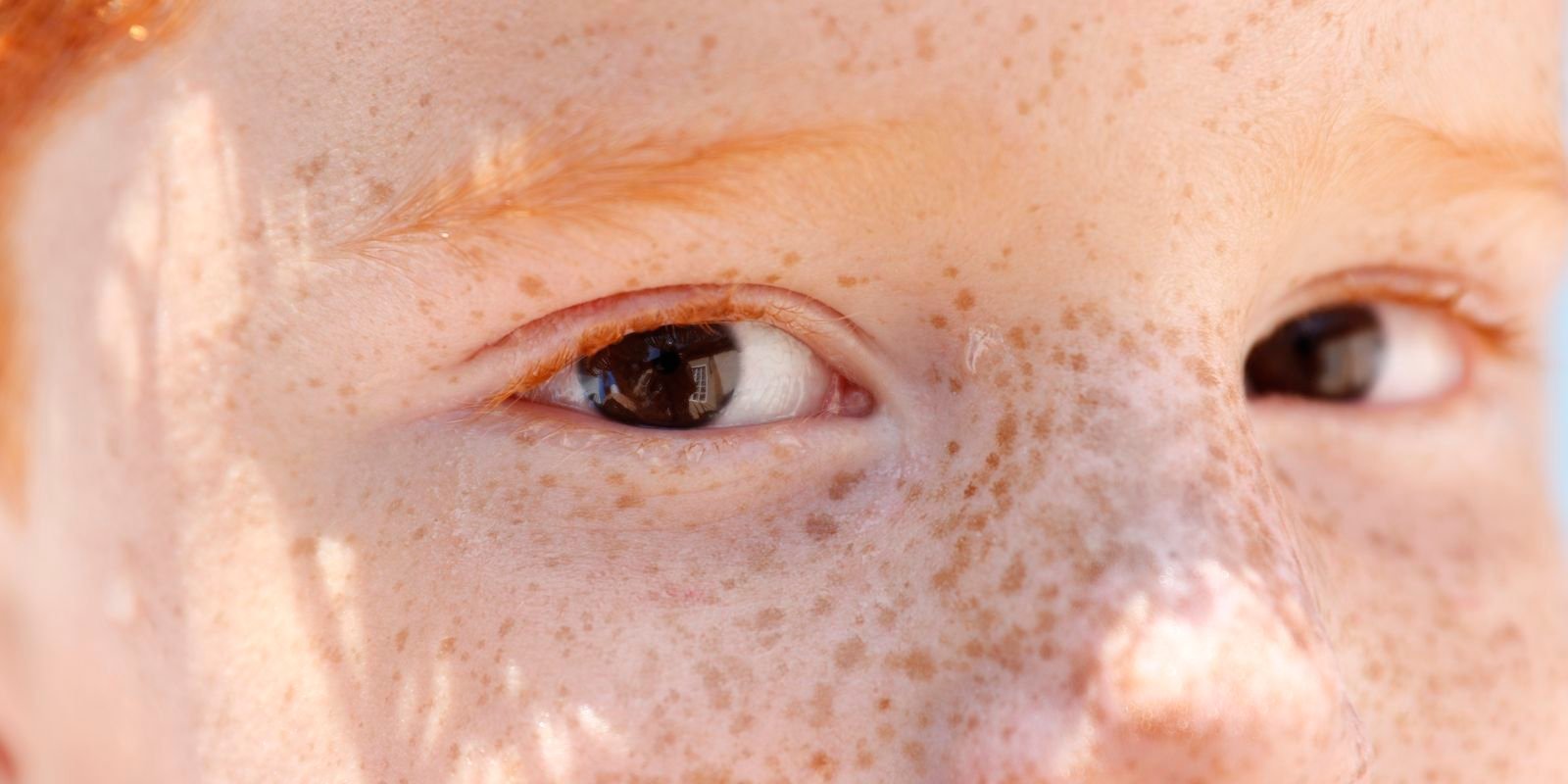 reflexo-branco-nos-olhos:-entenda-condicao-que-assusta-pais