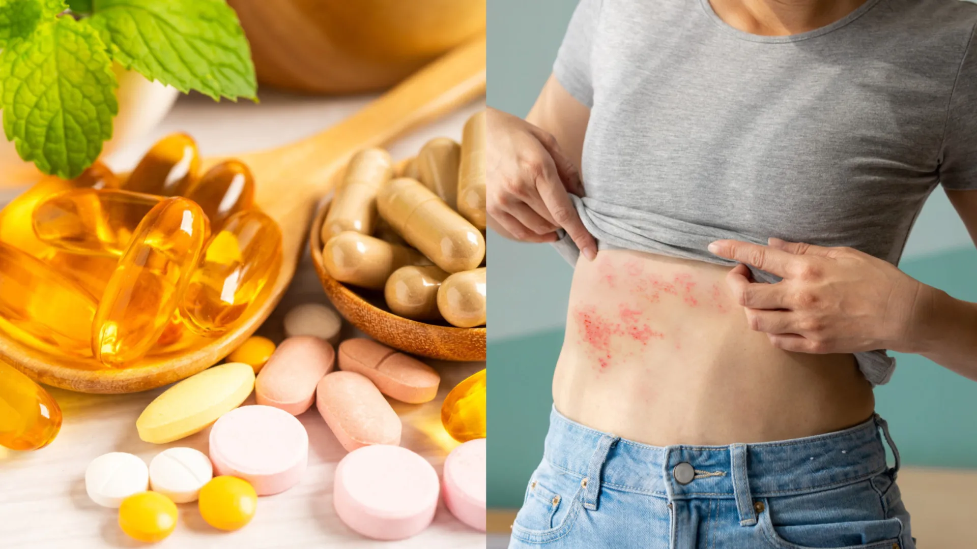 overdose-de-vitaminas:-perigos-e-efeitos-colaterais-de-toma-las-em-excesso!