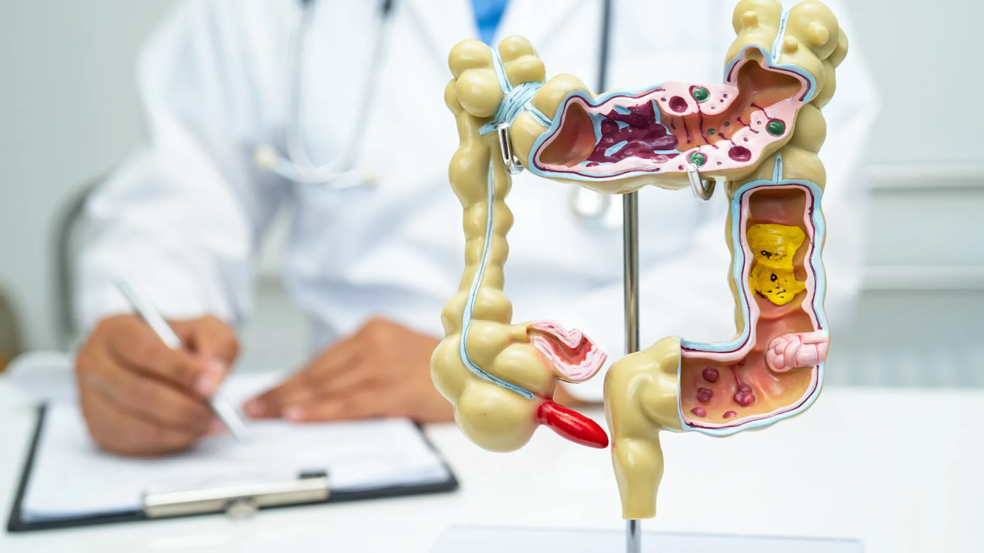 5-curiosidades-que-precisa-saber-sobre-doencas-inflamatorias-intestinais