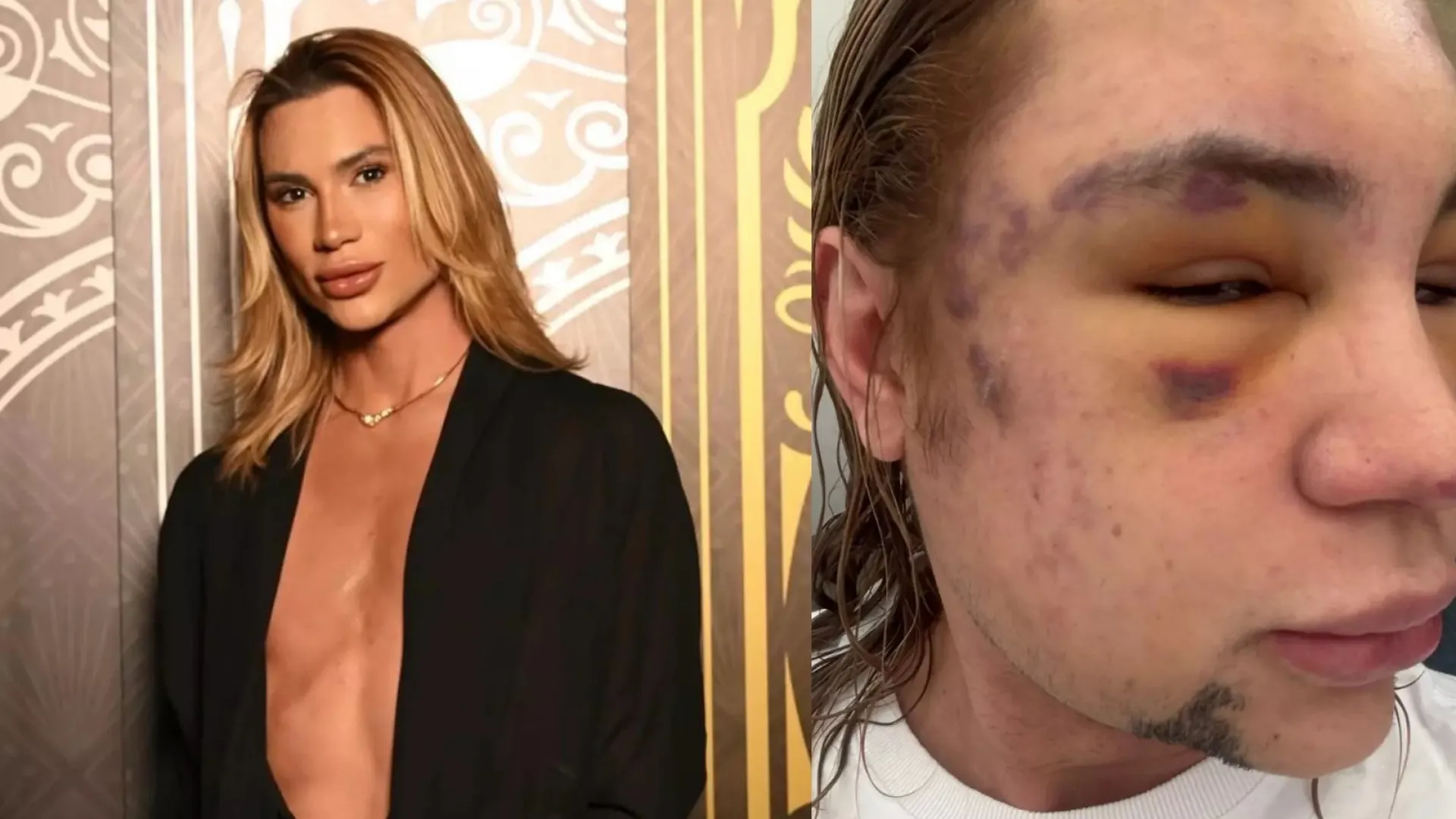 influenciador-junior-dutra-morre-apos-procedimento-estetico-malsucedido