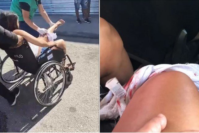 gravida-e-baleada-durante-tiroteio-e-passa-por-parto-de-urgencia