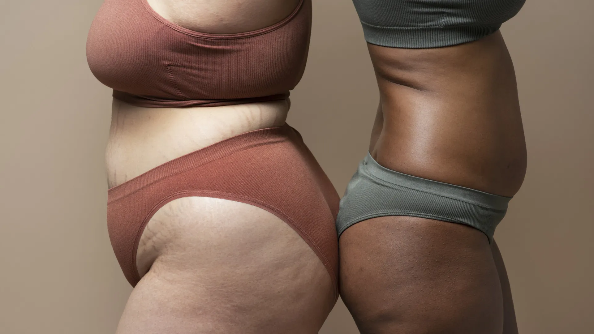 lipedema:-uma-doenca-pouco-conhecida-e-com-impacto-significativo