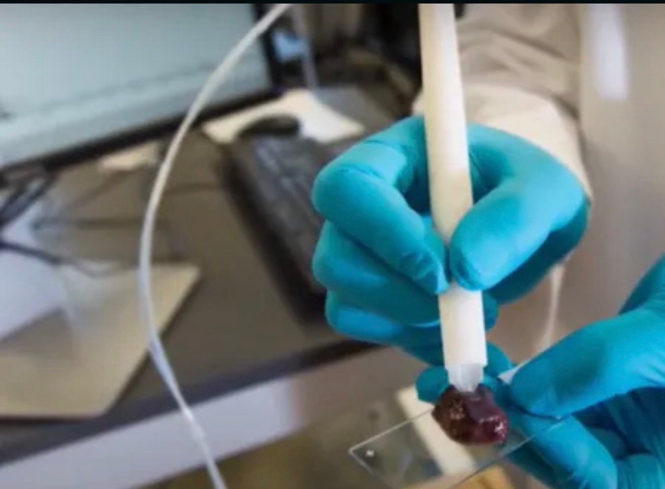 masspec-pen:-uma-revolucao-no-diagnostico-do-cancer