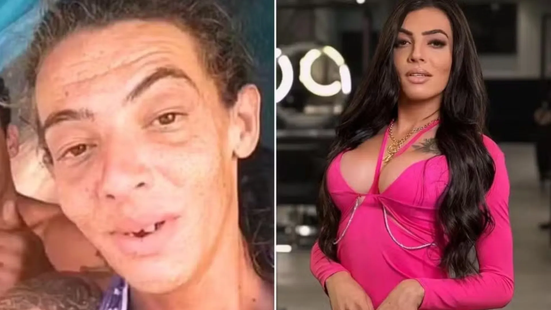 influenciadora-que-viveu-nas-ruas-faz-10a-cirurgia-e-impressiona