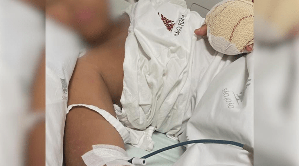 menino-brasileiro-tem-dedos-amputados-apos-agressao-em-escola-de-portugal