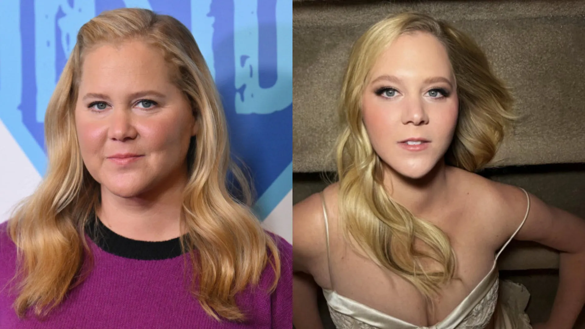 amy-schumer-perde-23-quilos-e-impressiona:-“fiz-isto-para-sobreviver”