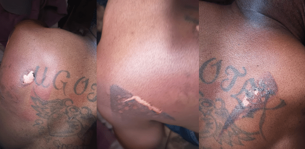 nigeriano-e-sequestrado-e-torturado-com-ferro-de-passar-por-20-horas-em-sp