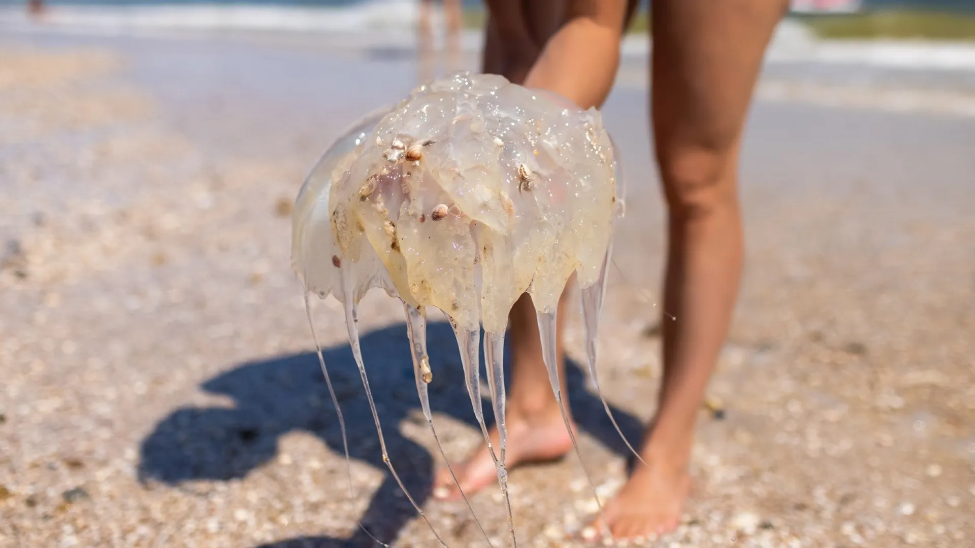 como-tratar-uma-queimadura-de-agua-viva-em-criancas?