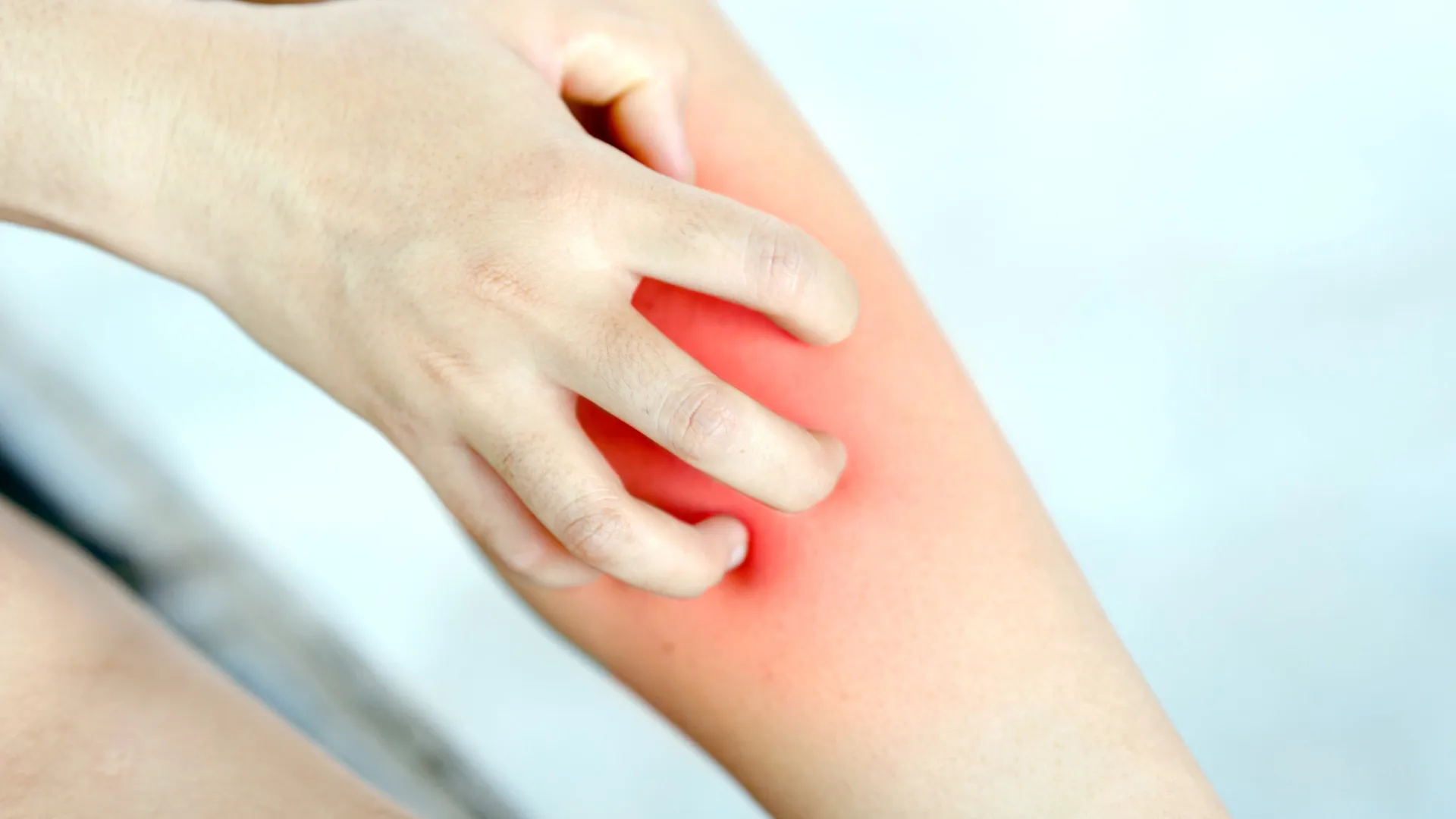 coceira-persistente-nas-pernas-pode-indicar-problemas-nas-veias