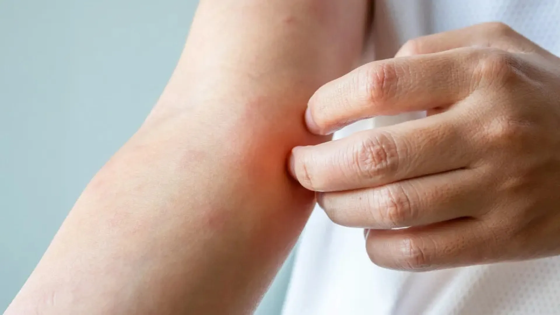 surto-de-fungo-sexual-“altamente-contagioso”-preocupa-europa