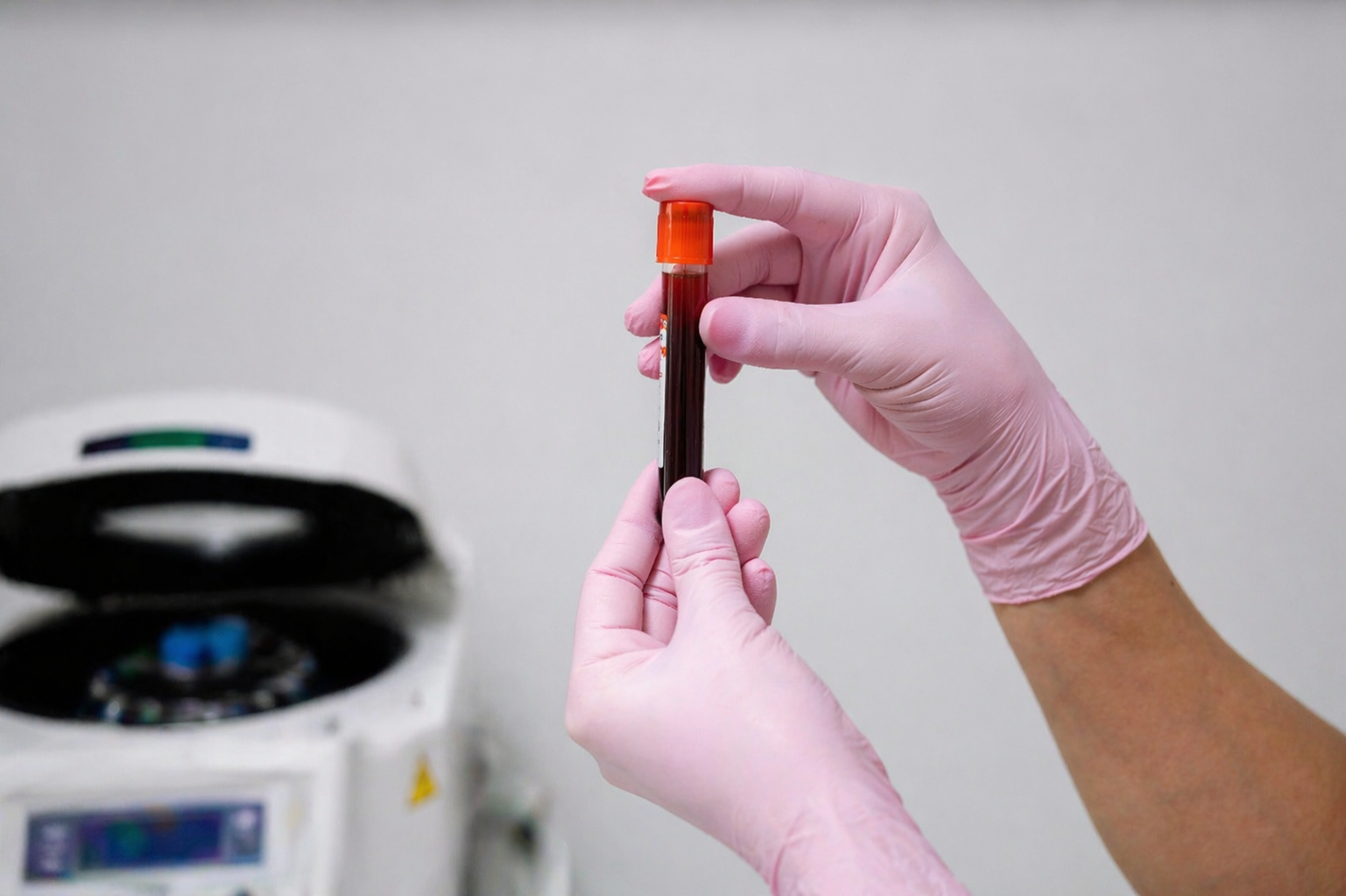 iamspe-passa-a-integrar-rede-nacional-de-doacao-de-plasma-para-producao-de-medicamentos