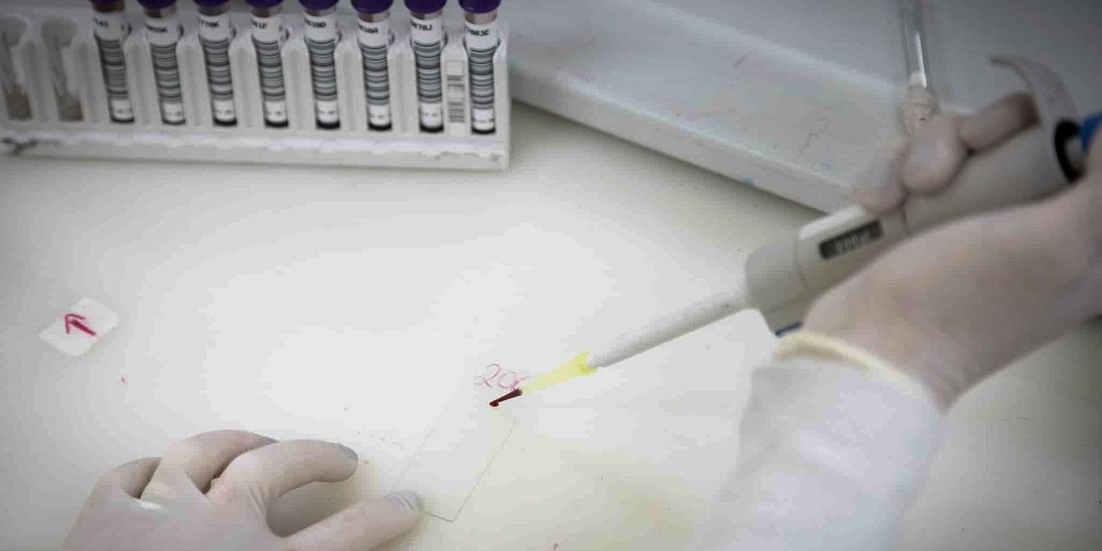 Secretaria de Saúde de SP investiga novo caso suspeito de ebola