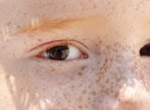 reflexo-branco-nos-olhos:-entenda-condicao-que-assusta-pais