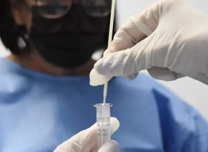 rj:-cenario-epidemiologico-de-covid-19-tem-tendencia-de-reducao