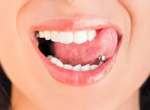 entenda-os-riscos-e-cuidados-necessarios-com-o-uso-do-piercing-bucal