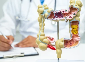 5-curiosidades-que-precisa-saber-sobre-doencas-inflamatorias-intestinais