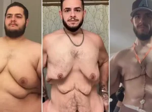 antes-e-depois:-influencer-perde-150-kg-e-retira-7-kg-de-excesso-de-pele