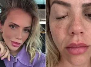 apresentadora-e-infectada-por-bacteria-com-poder-de-cegar