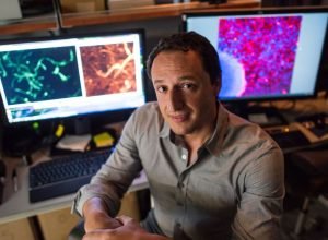 cientista-explica-como-chumbo-influenciou-na-evolucao-do-cerebro-humano