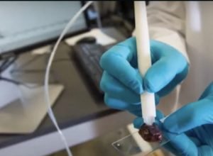 masspec-pen:-uma-revolucao-no-diagnostico-do-cancer