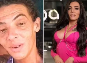 influenciadora-que-viveu-nas-ruas-faz-10a-cirurgia-e-impressiona