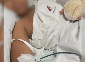 menino-brasileiro-tem-dedos-amputados-apos-agressao-em-escola-de-portugal