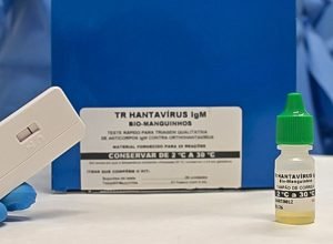 novo-teste-faz-diagnostico-de-hantavirose-em-20-minutos
