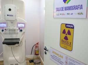 lei-garante-mamografia-pelo-sus-para-mulheres-a-partir-dos-40-anos