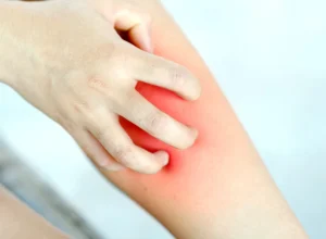 coceira-persistente-nas-pernas-pode-indicar-problemas-nas-veias