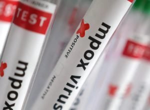 sobe-para-140-numero-de-casos-confirmados-de-mpox-no-pais,-em-2026