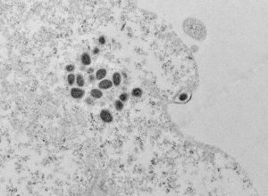 brasil-registra-140-casos-confirmados-de-mpox-em-2026,-aponta-ministerio-da-saude
