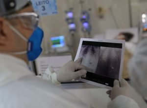 broncopneumonia:-entenda-quadro-que-causou-internacao-de-bolsonaro