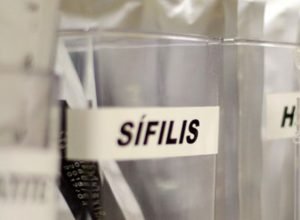sus-passa-a-adotar-antibiotico-para-prevenir-sifilis-e-clamidia