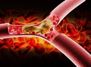 sociedades-americanas-de-cardiologia-atualizam-diretrizes-para-controle-do-colesterol