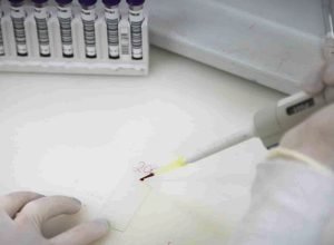secretaria-de-saude-de-sp-investiga-novo-caso-suspeito-de-ebola