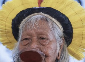 raoni-faz-transicao-para-dieta-oral-e-tem-evolucao-no-quadro-de-saude